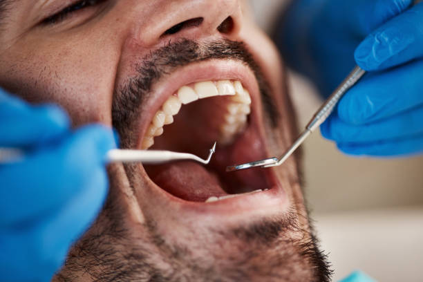 Best Broken or Chipped Tooth Repair in Surfside Beach, SC