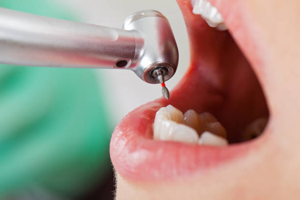 Best Emergency Treatment for Oral Infections in Surfside Beach, SC